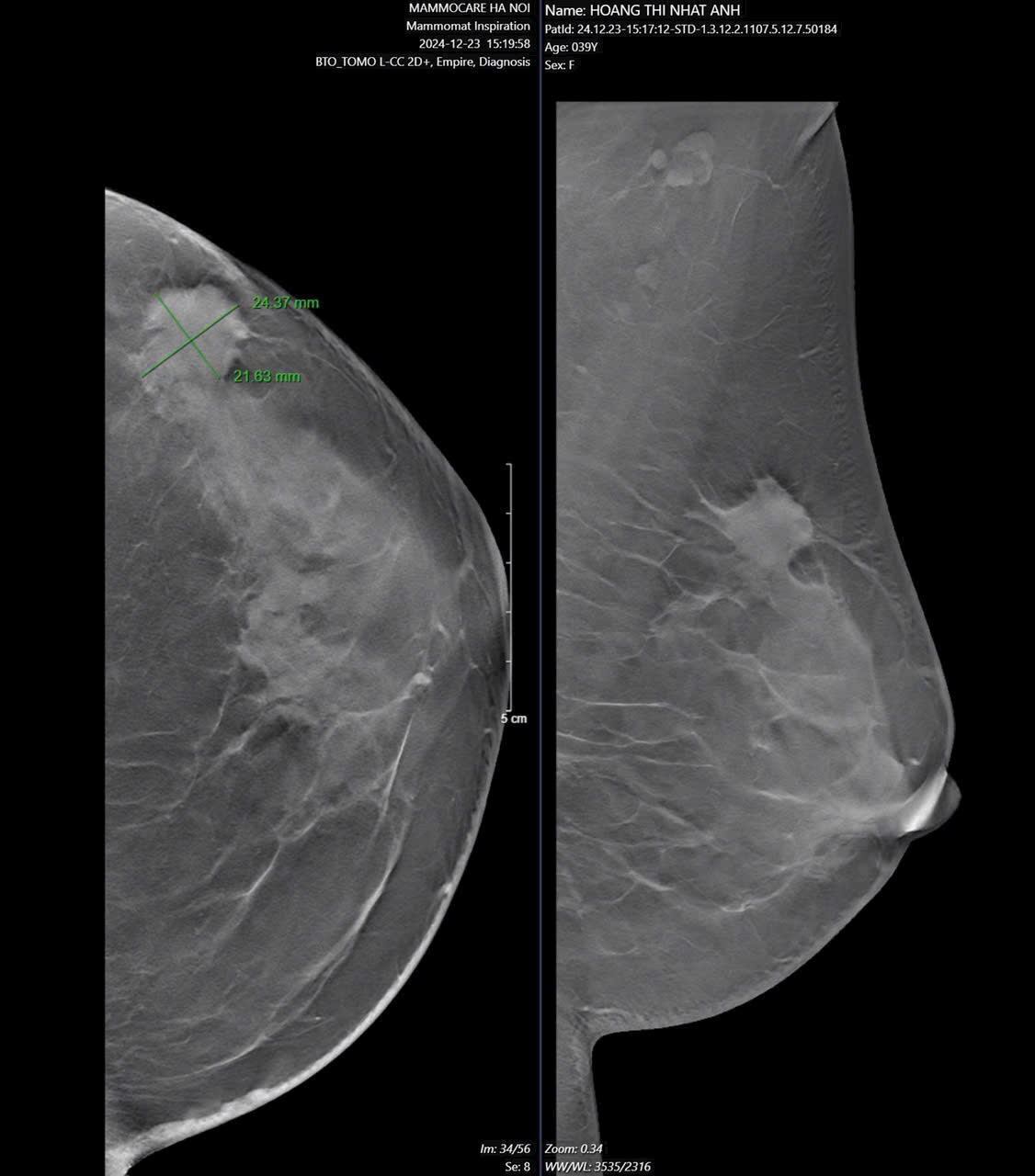Khám Sức Khỏe Theo Cơ Quan Có Đủ Bảo Vệ Bạn Không?