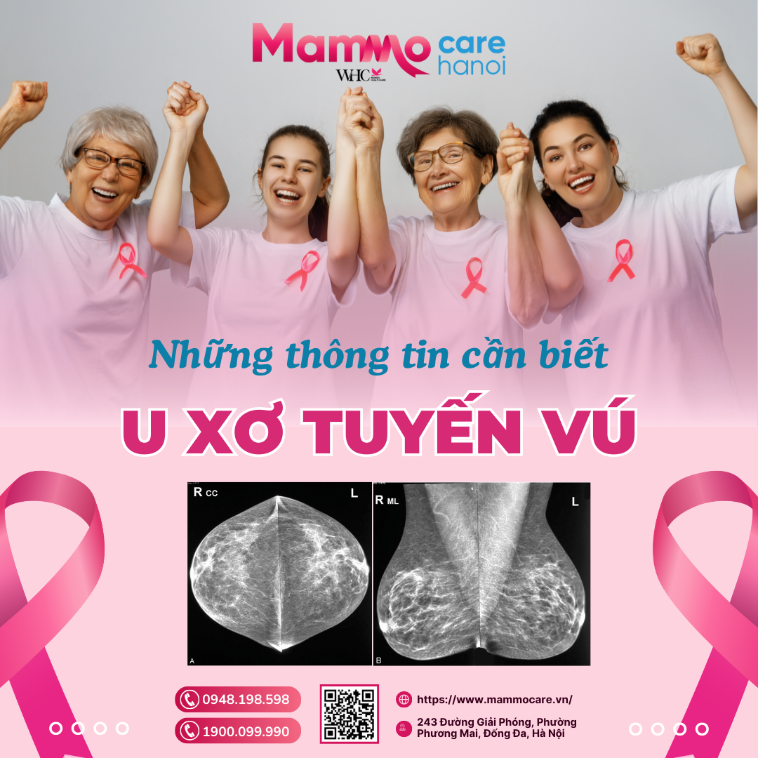 U Xơ Tuyến Vú: Nguyên Nhân, Triệu Chứng Và Phương Pháp Điều Trị