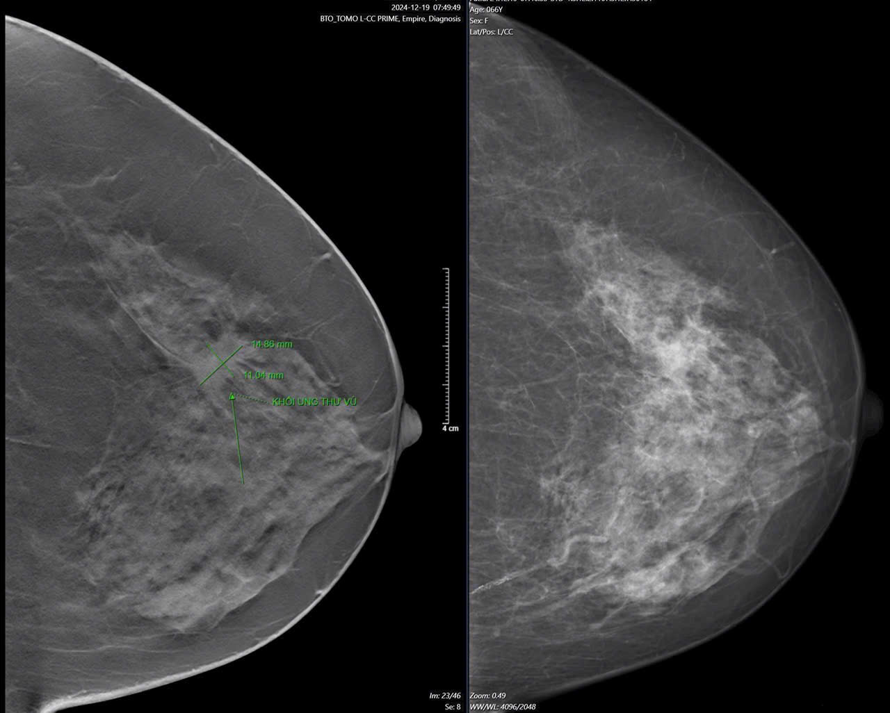 Lắng Nghe Cơ Thể – Quyết Định Đúng Đắn Cứu Sống Một Bệnh Nhân